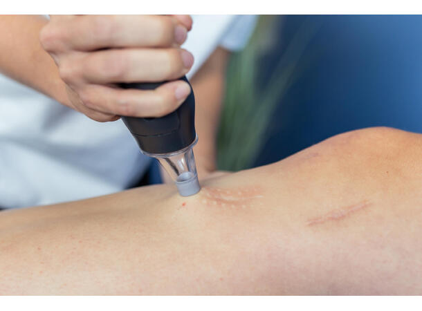 Workshop med LymphaTouch - Vakuumterapi Oslo, 15. mai 2025