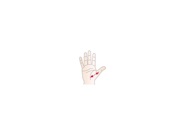 Actimove Rhizo Forte Venstre Small Tommelortose 