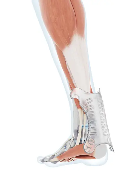 Bauerfeind AchilloTrain Str. 1 Sort 