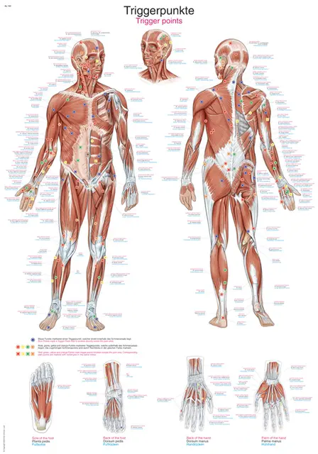 Plakat Trigger Points AL560 