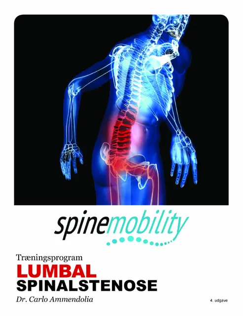 Lumbal Spinal Stenosis Bok Treningsprogram 