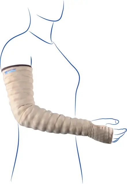 Mobiderm Armstrømpe Målsydd Med Hånd Uten Tommel 