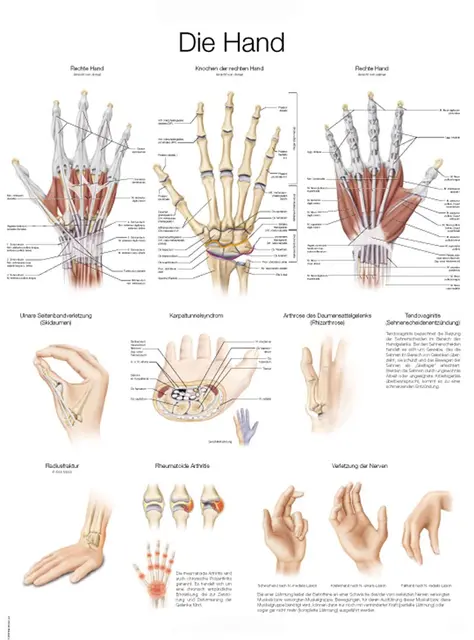 Plakat Hand and Wrist AL529 