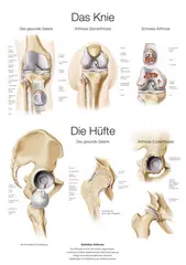 Plakat The Knee &amp; Hip AL551 50 x 70 cm Plast