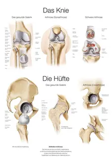 Plakat The Knee &amp; Hip AL551 50 x 70 cm Plast